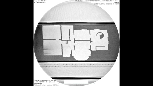 Your House - an X-ray film by SHIMURAbros