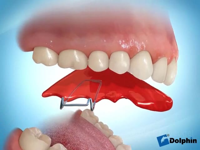 Wat doet een orthodontist?