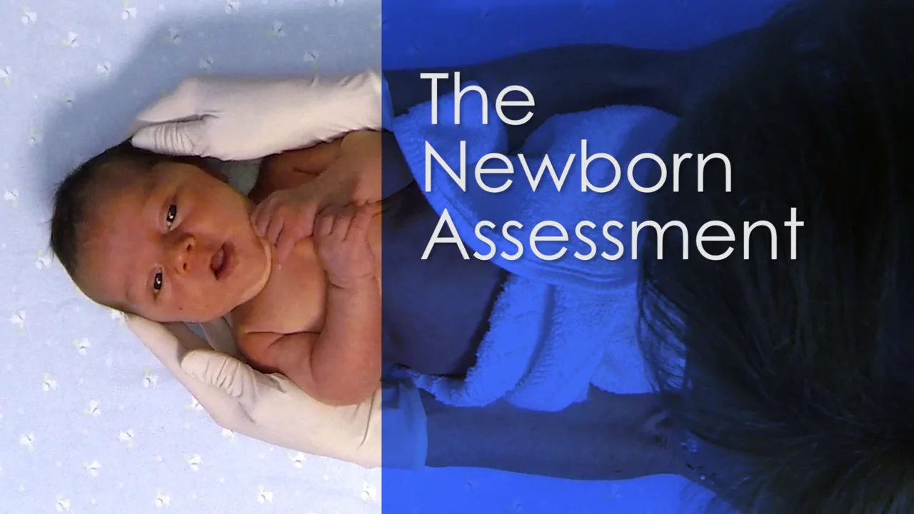 Newborn Assessment  