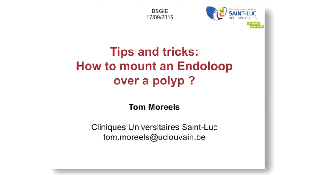 Tips and tricks How to mount an Endoloop over a polyp? (Tom Moreels