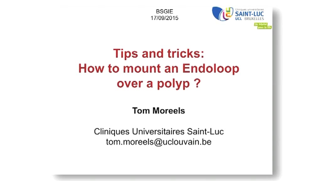 Tips and tricks How to mount an Endoloop over a polyp? (Tom Moreels) on Vimeo