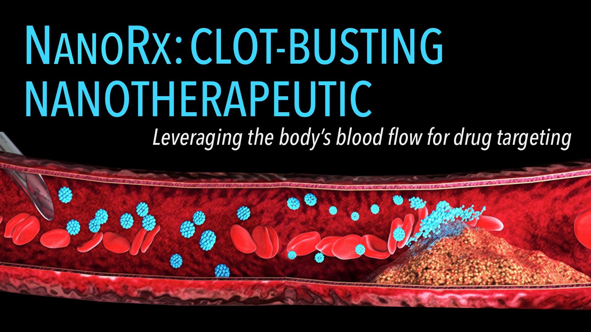 NanoRx: Clot-Busting Nanotherapeutic