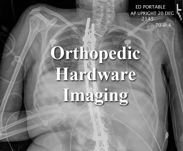 Orthopedic Hardware Imaging on Vimeo