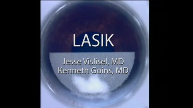 Laser-assisted in-situ keratomileusis (LASIK)