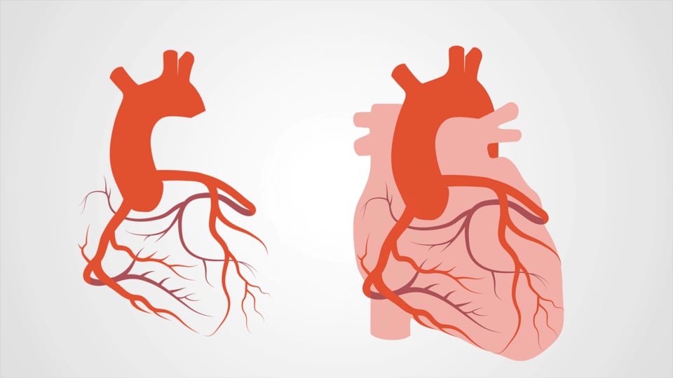 Coronary Anatomy Refresher