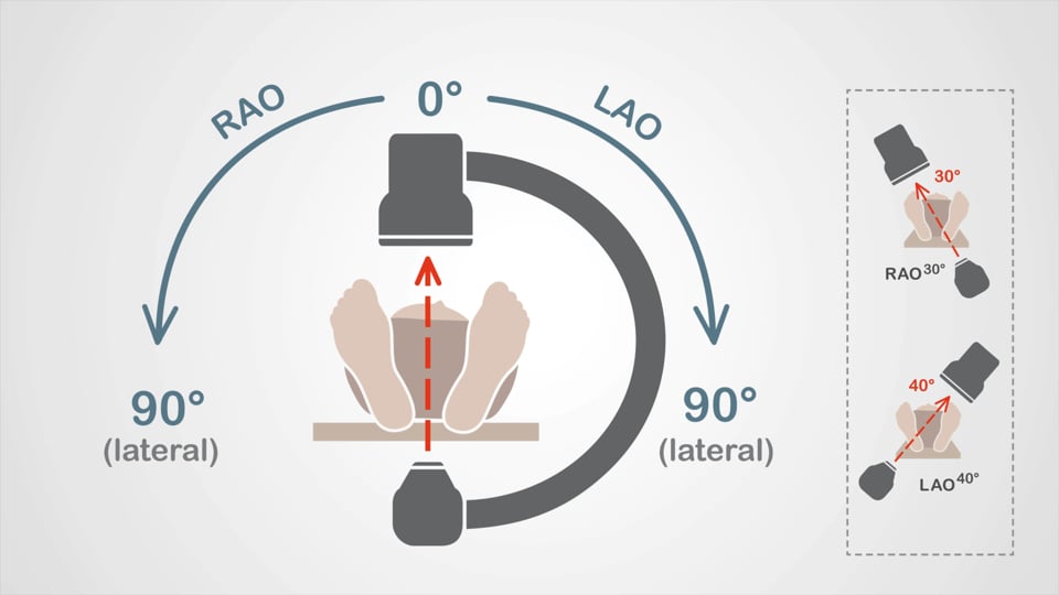 Image intensifier basics and nomenclature