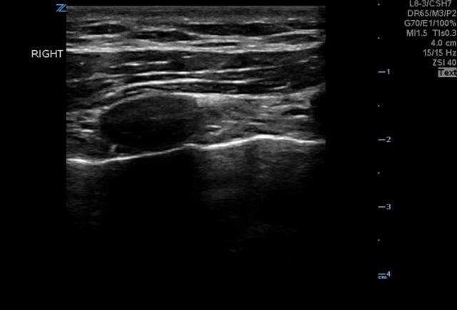 Hennepin Ultrasound