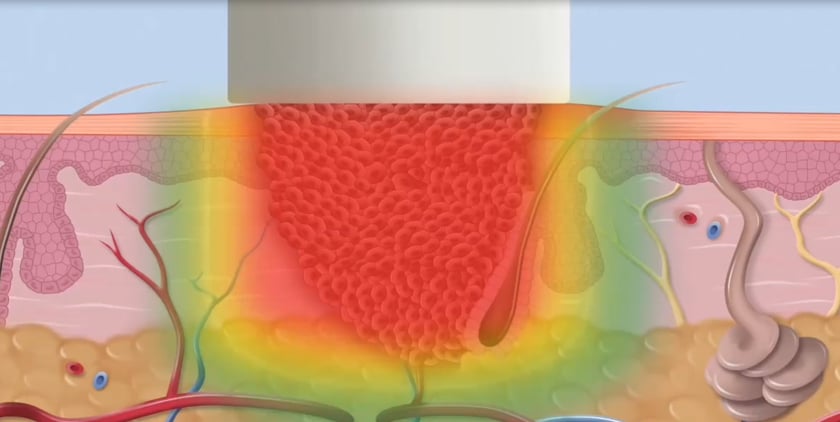 vimeo-video-thumbnail