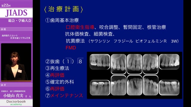 歯科衛生士という仕事を通じて学んだこと