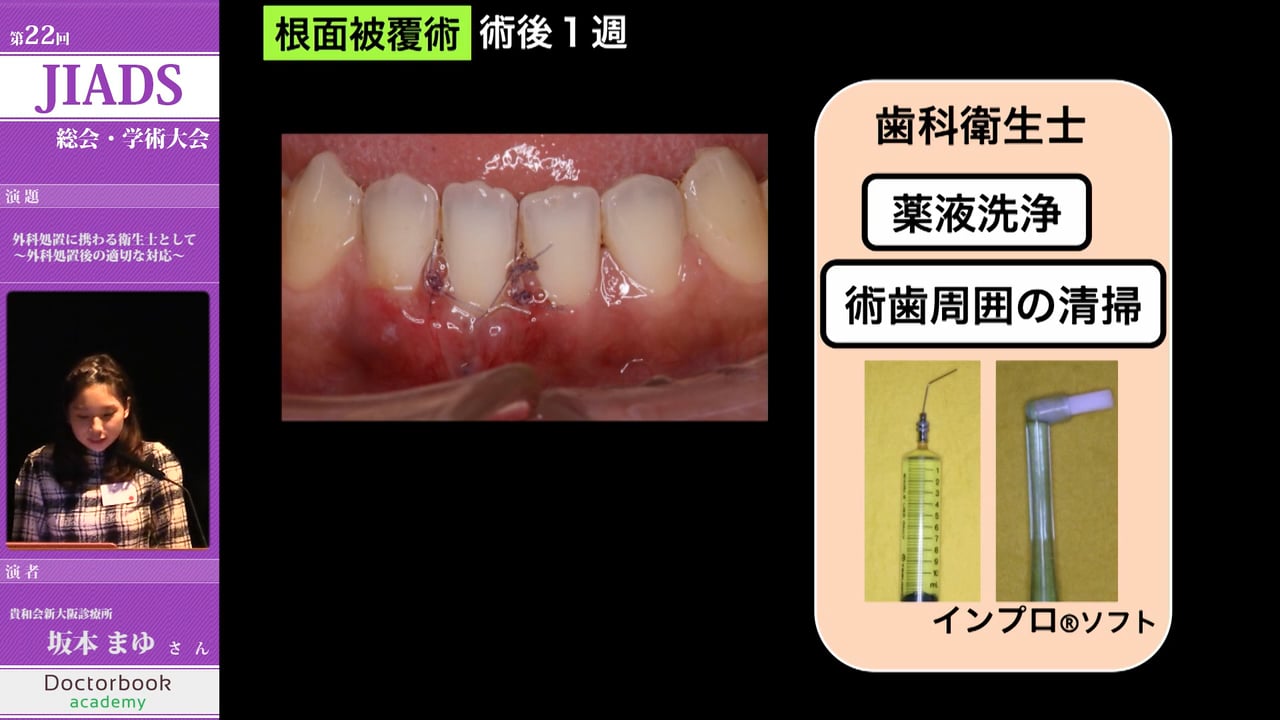 外科処置に関わる歯科衛生士として ～外科処置後の適切な対応～