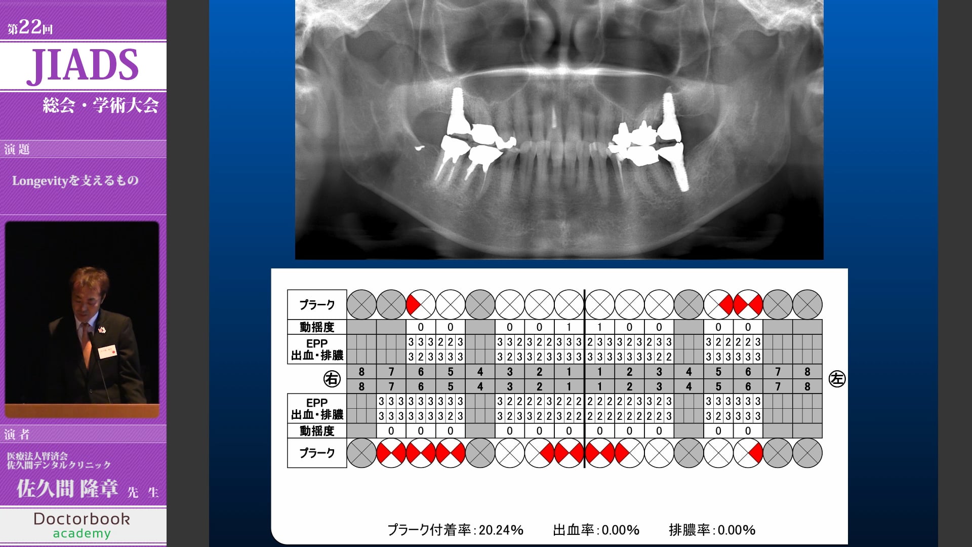 Longevityを支えるもの