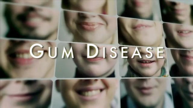 Gum Disease