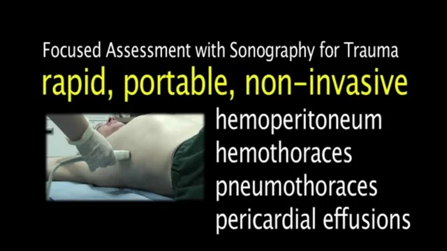 Focused assessment with sonography for trauma - Wikipedia