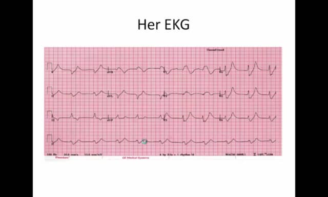 Kayexalate use for Hyperkalemia in the Emergency Department - More Harm ...