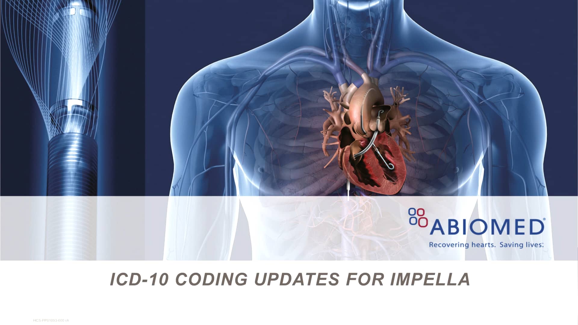 Hot Topics in Impella Reimbursement 2016 ICD10 Coding Updates on Vimeo