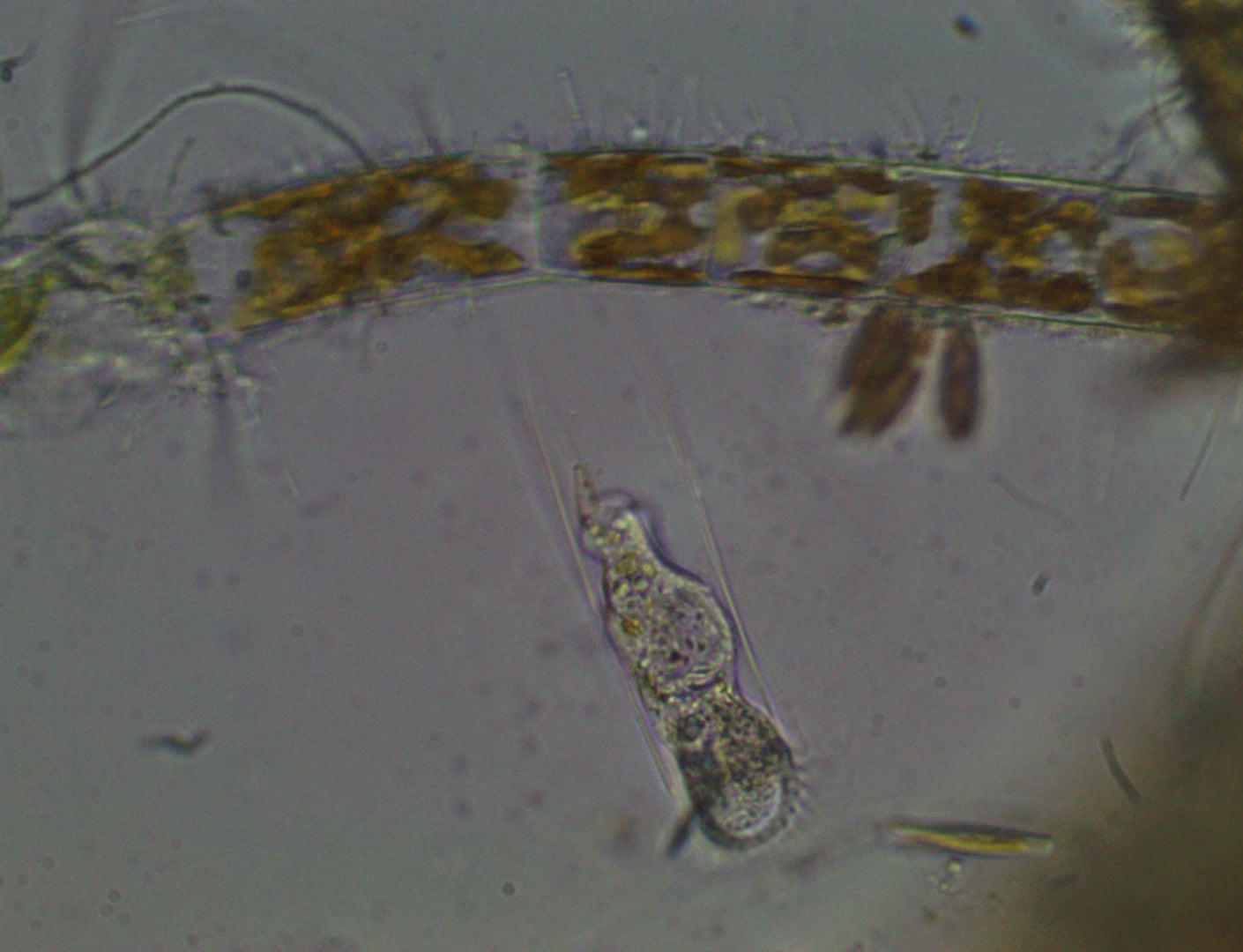 Ciliate Eutintinnus X600 Tp Pool June 9 2015 (4) On Vimeo