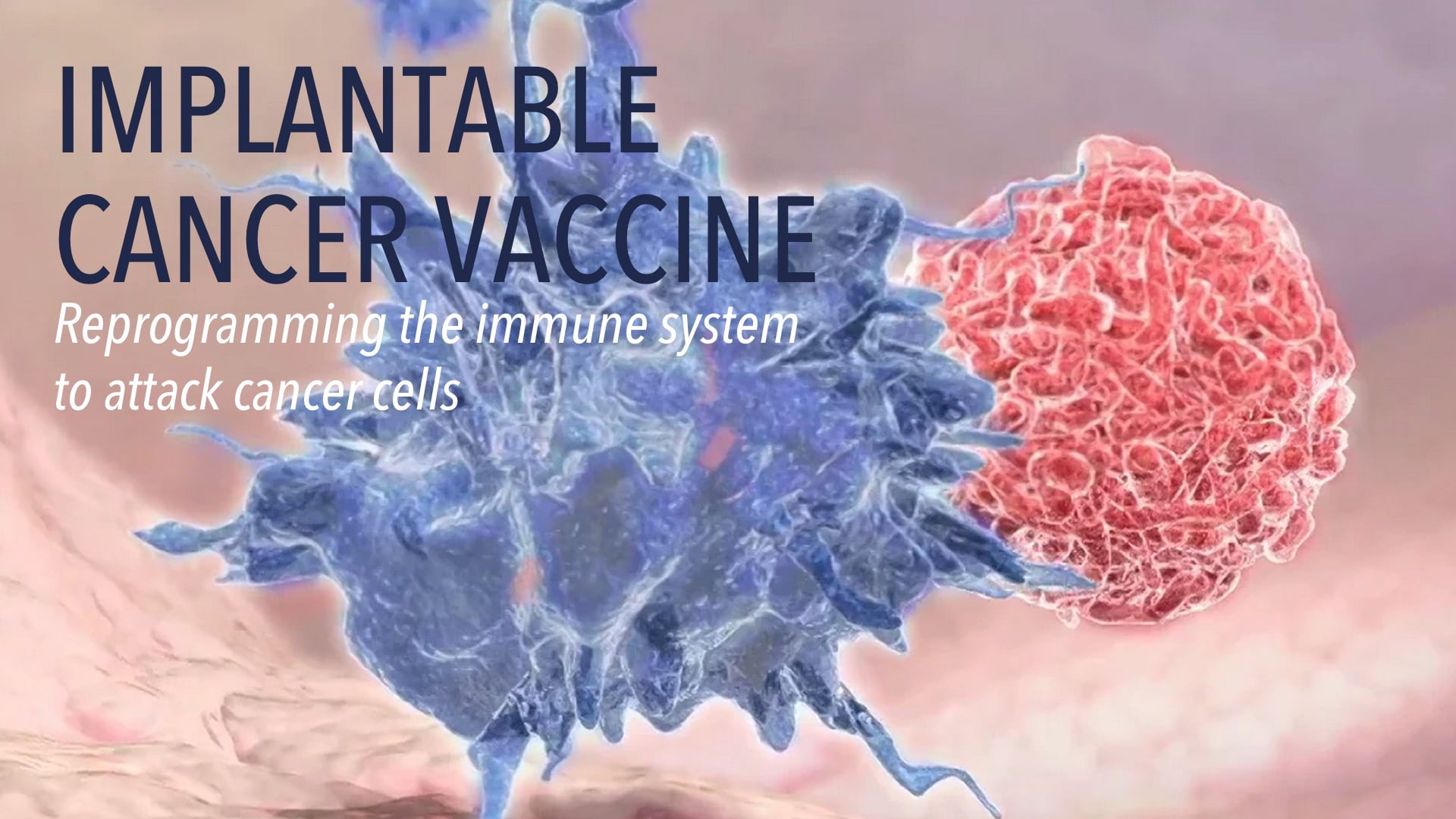 Implantable Cancer Vaccine