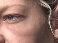 VICENZA – "IO, AGGREDITA A BORGO BERGA"