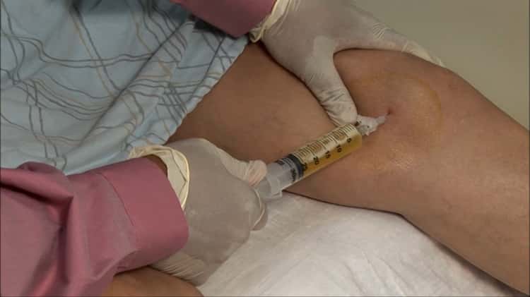 Knee Aspiration and Injection - Medial Approach on Vimeo