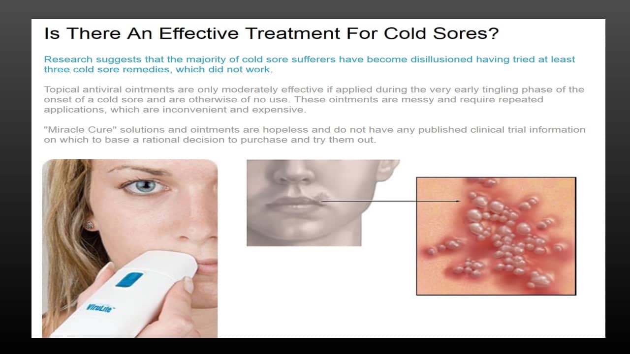 Virulite electronic cold sore treatment device on Vimeo