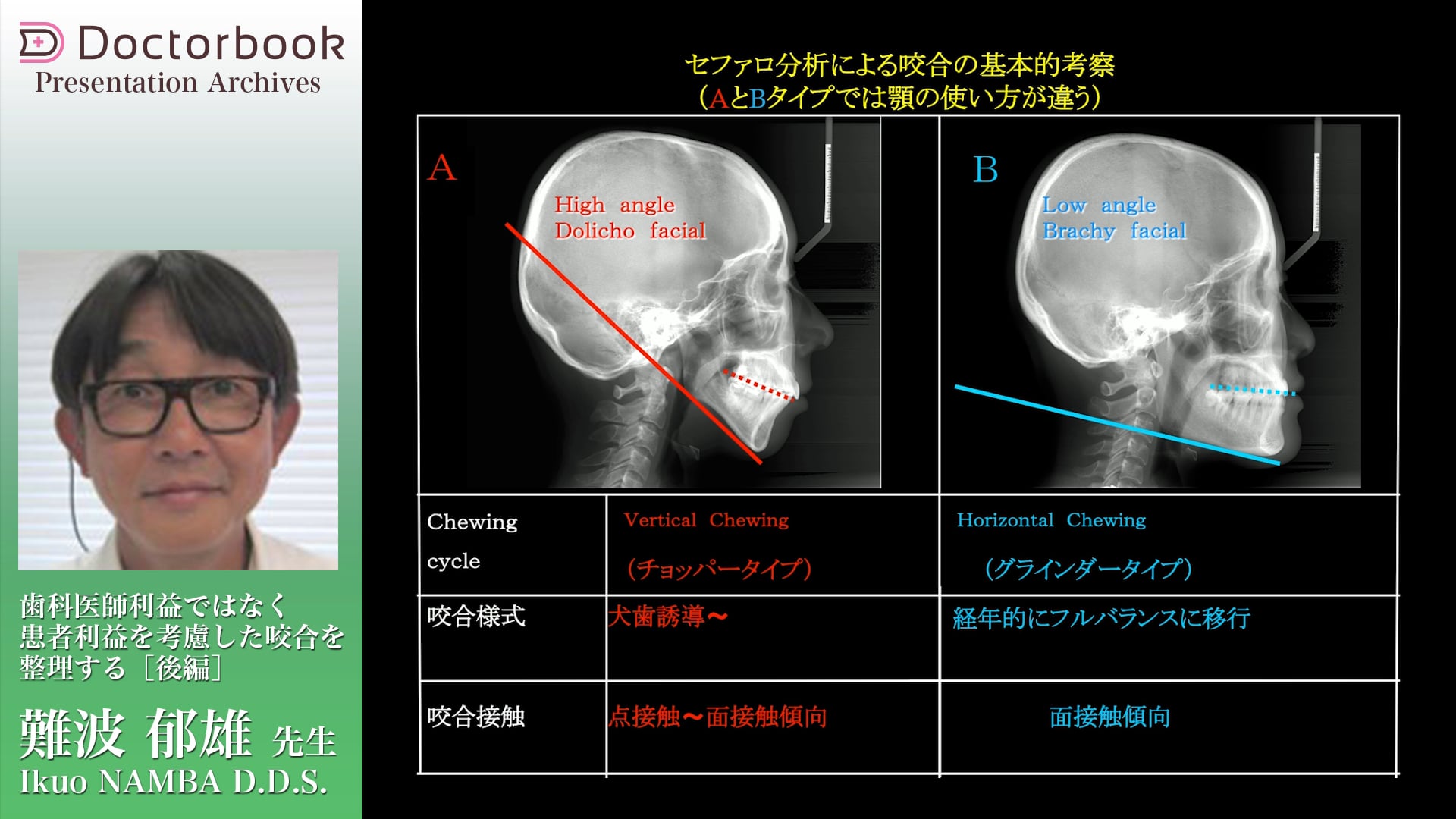 患者利益を考慮した咬合を整理する（後編）