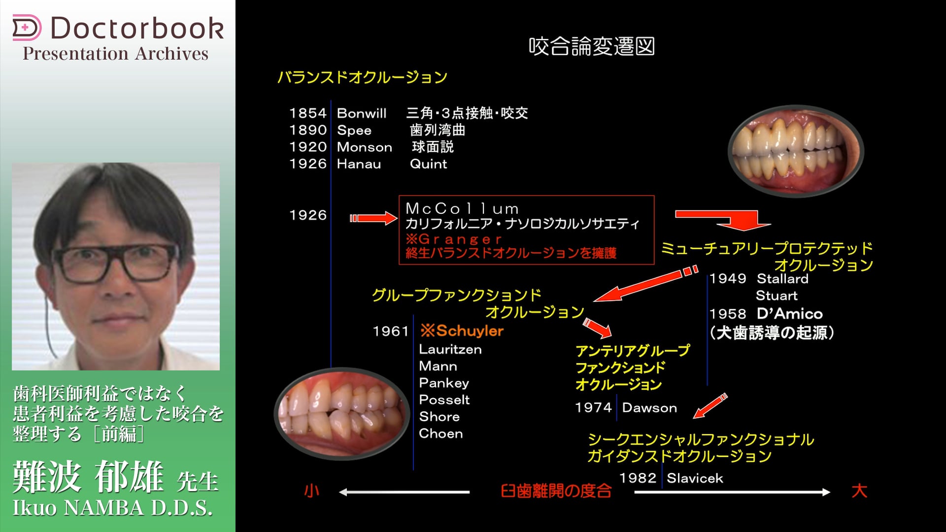 患者利益を考慮した咬合を整理する（前編）