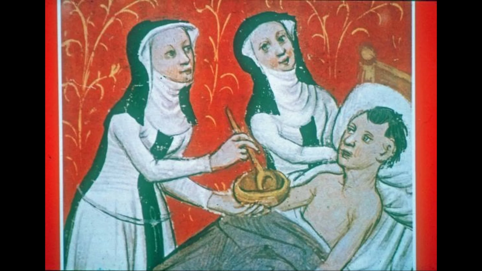 Кровопускание в средневековь. Средневековье кровопускание гутенберг. Лекари которые лечили. Кровопускание в средневековье. Лекари которые лечили.