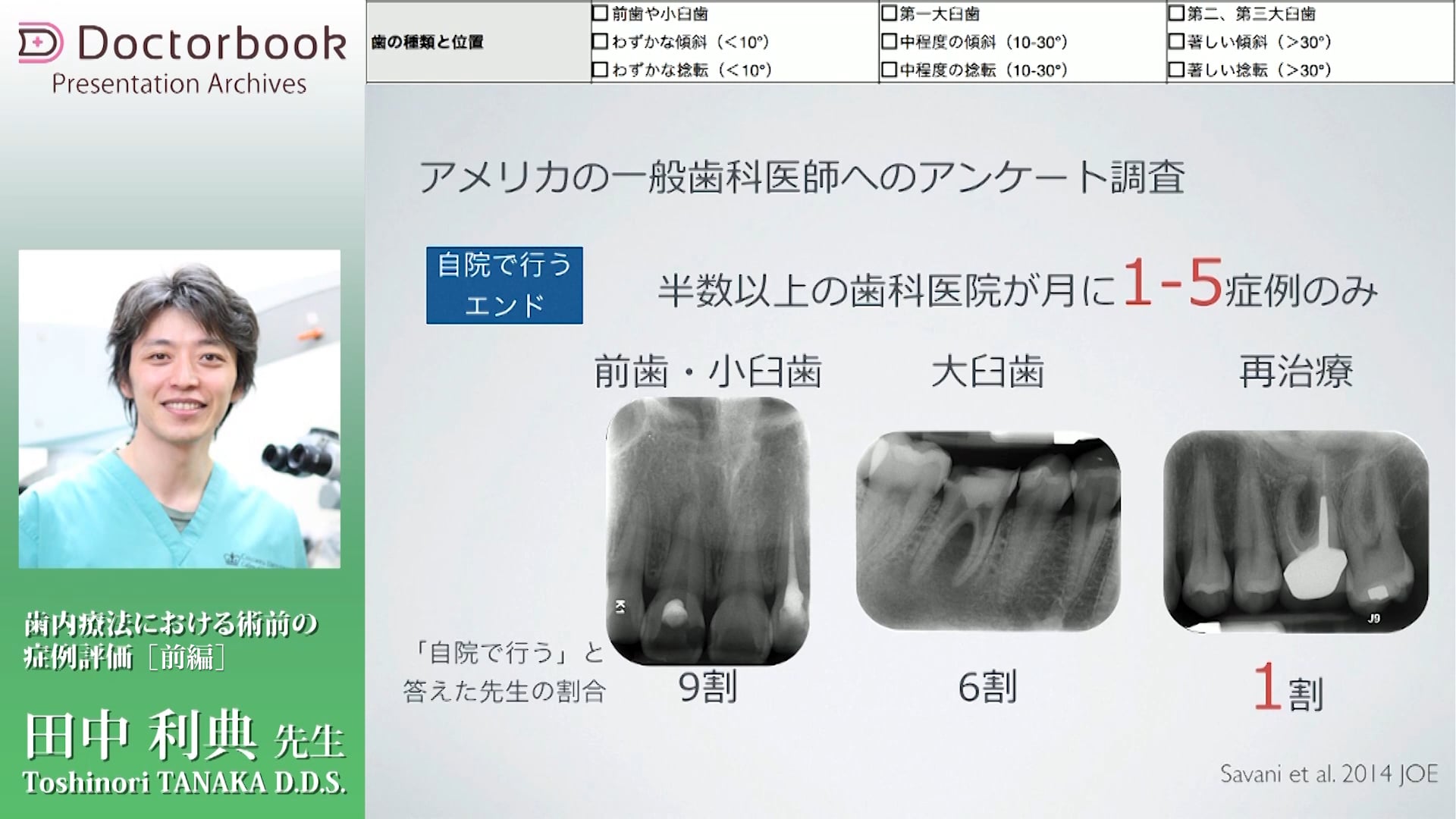 歯内療法における術前の症例評価（前編）