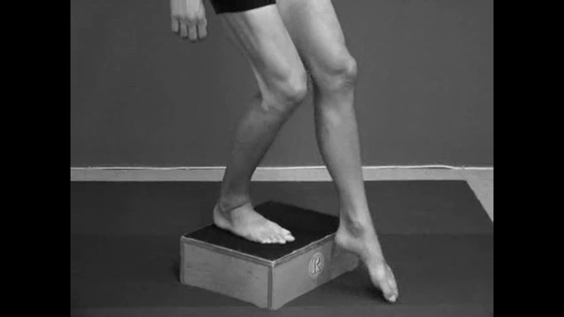 Knee Laxity Lateral Compartment