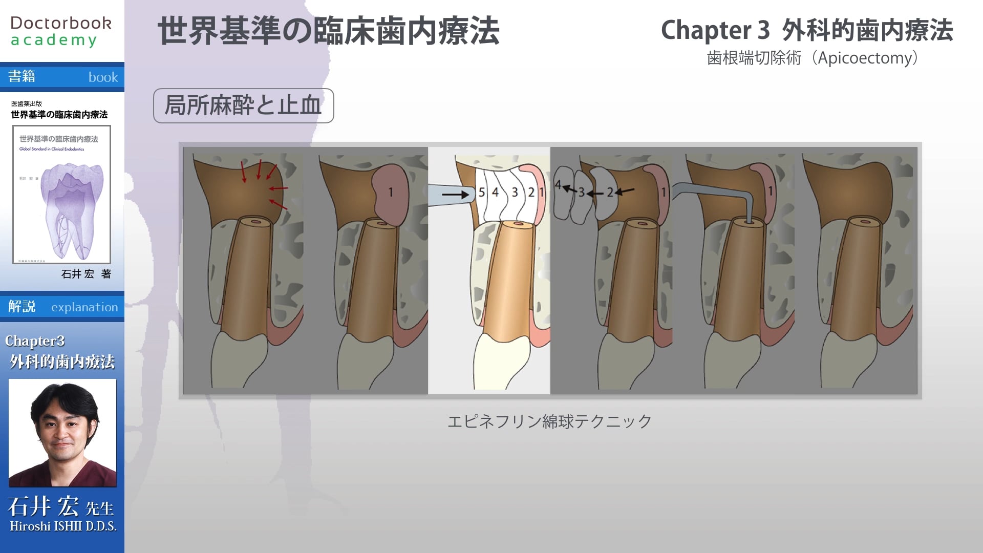 世界基準の臨床歯内療法】石井宏 医歯薬出版☆歯科 治療 診療 - 健康と医学