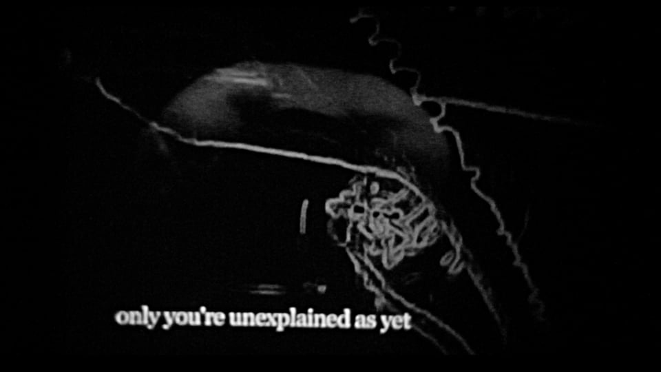 unexplained as yet