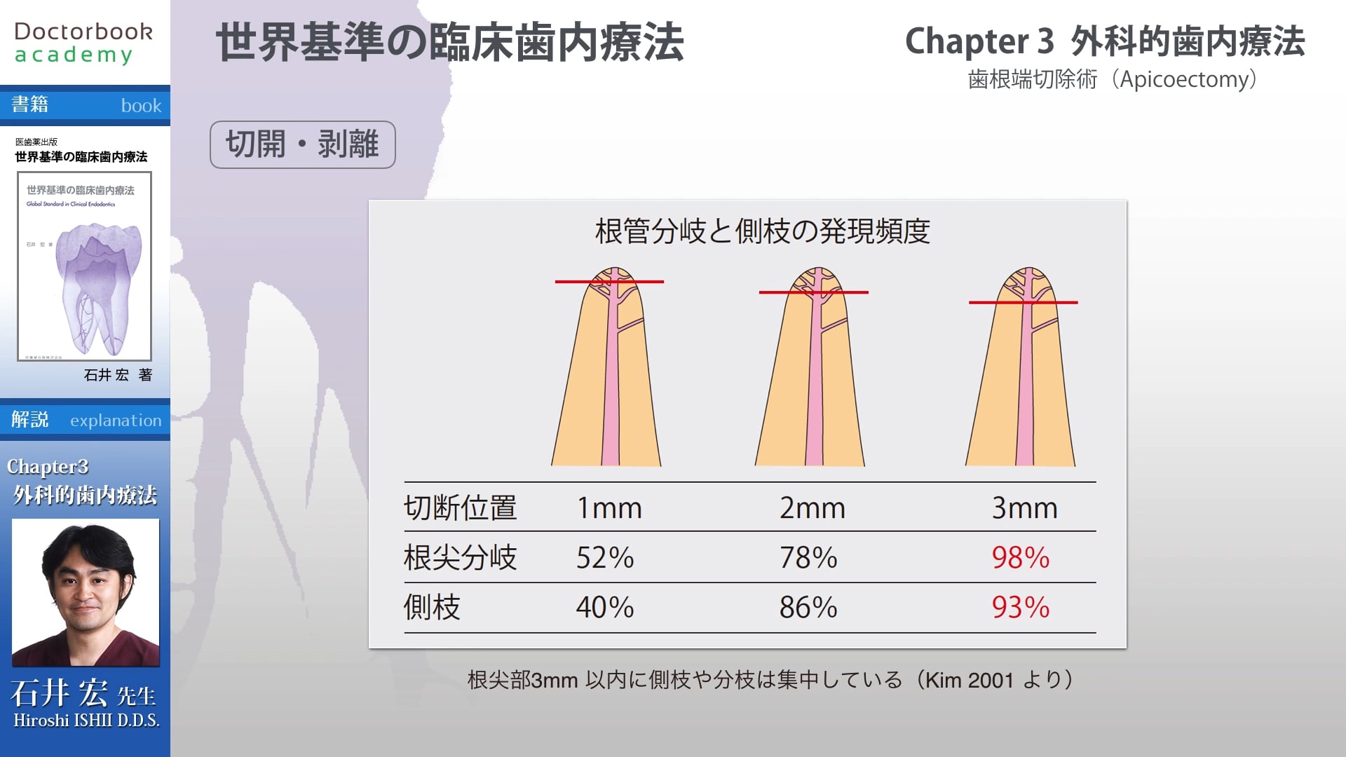 【BookReview】『世界基準の臨床歯内療法』#3