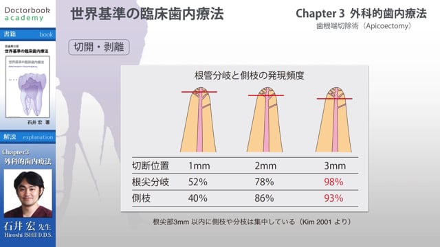 BookReview】『世界基準の臨床歯内療法』#2 | Doctorbook academy 