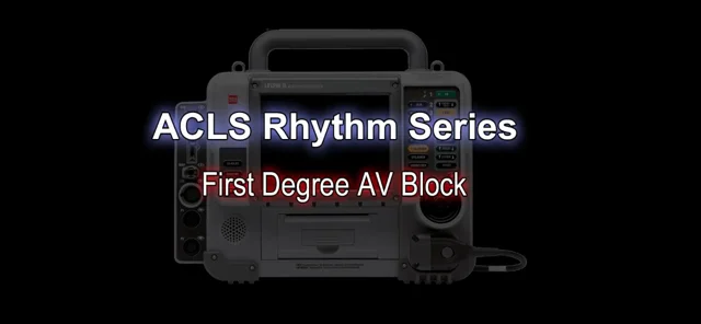 First-degree AV block (AV block I, AV block 1) – ECG & ECHO