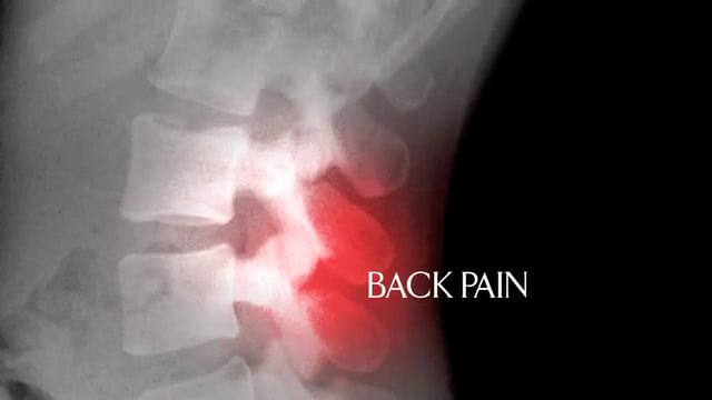 Pain Management Centers: Back Pain