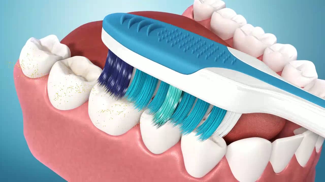 systema 3d clean