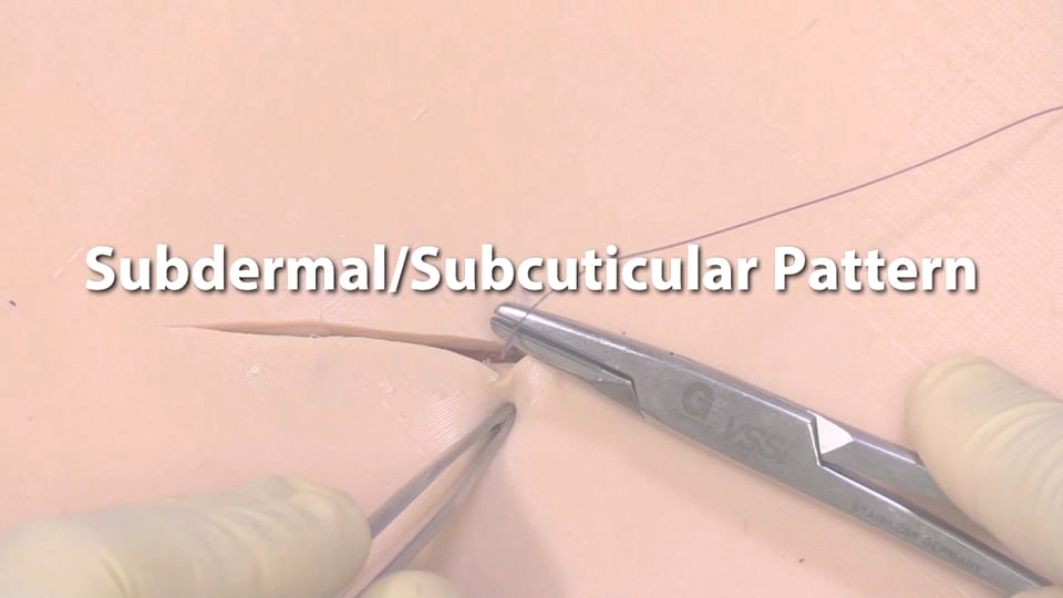 Subdermal Subcuticular Pattern on Vimeo