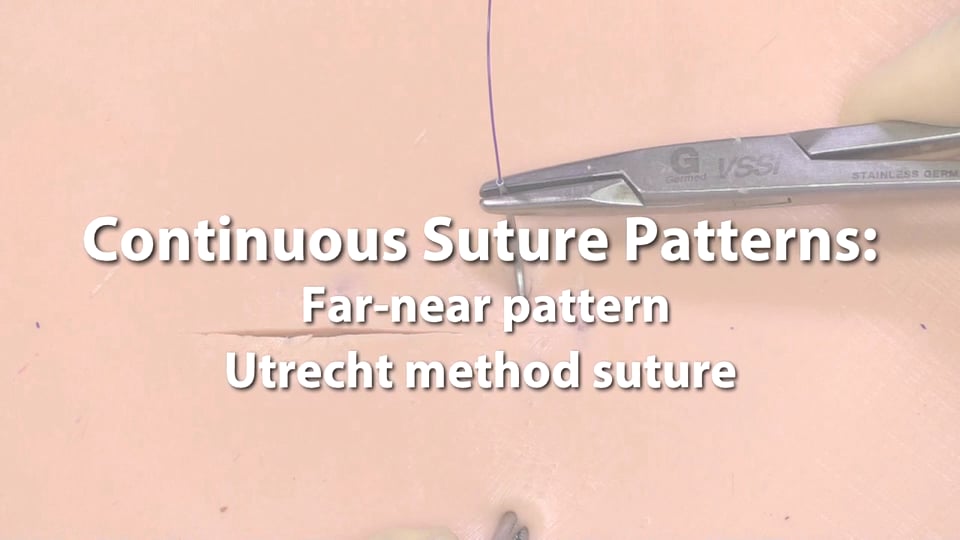 Continuous Suture Patterns: Far-near pattern Utrecht method suture on Vimeo