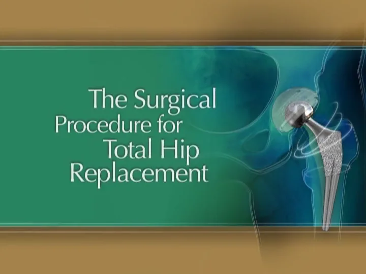 SPS Hip Procedure on Vimeo