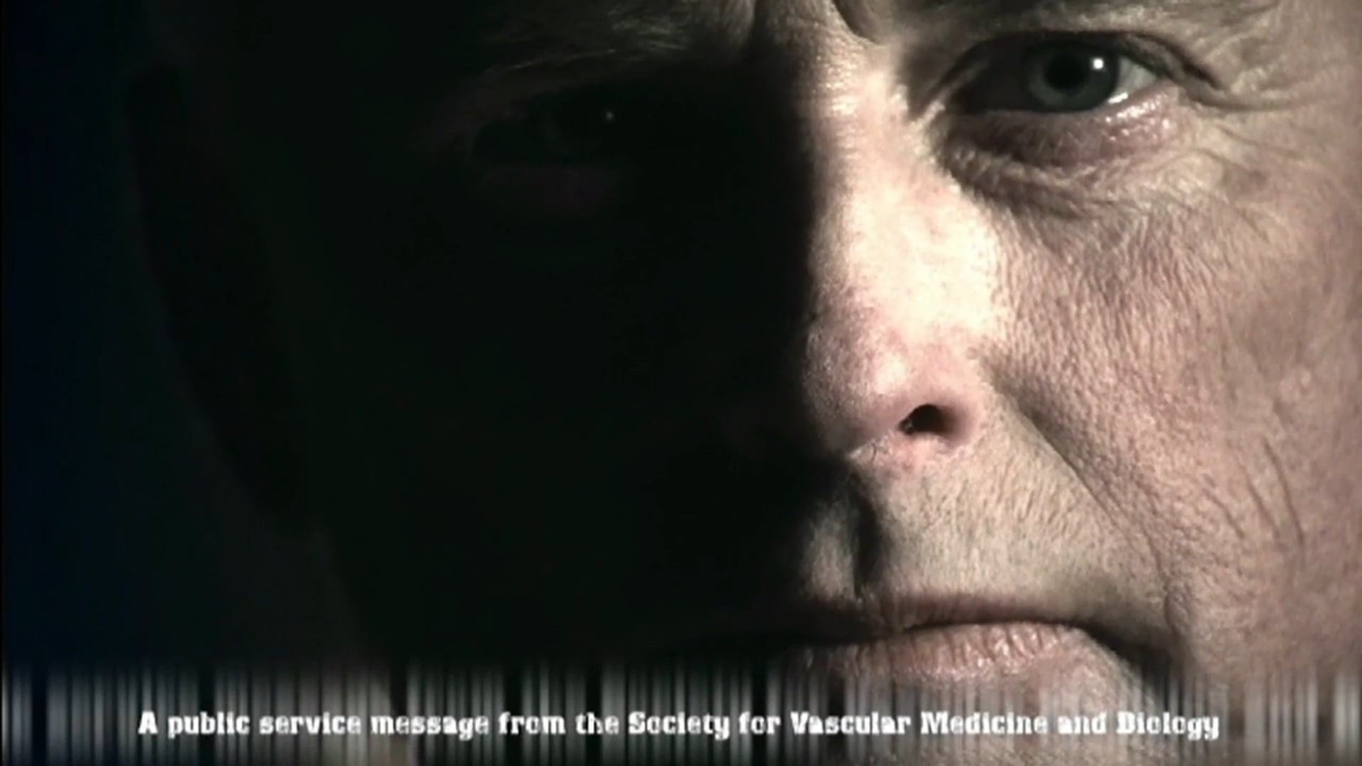 Merck DVT Commercial