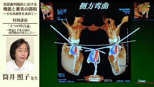 日本包括歯科臨床学会特別講演「2つの咬合論」 | Doctorbook academy 