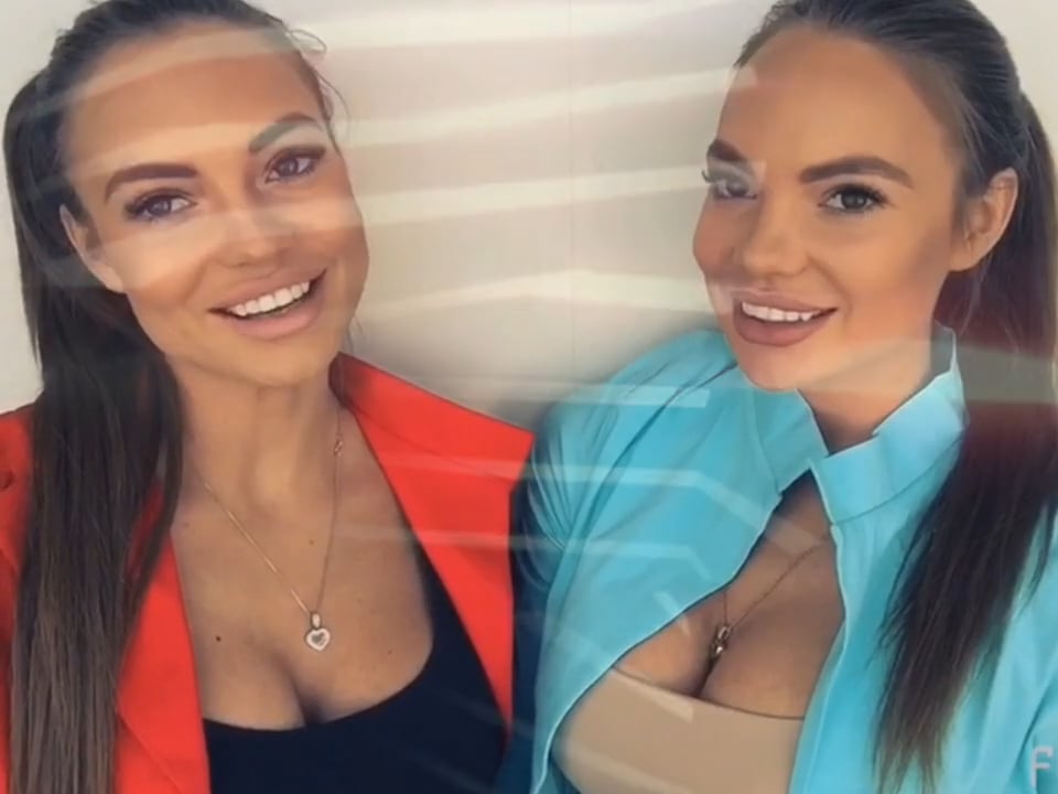 Dj twins до пластики фото