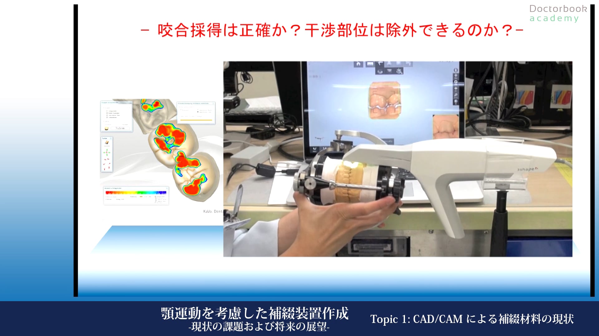 #1 CAD/CAMによる補綴材料の現状 