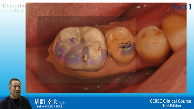 CEREC Clinical Course（CCC）トライアルエディション #1