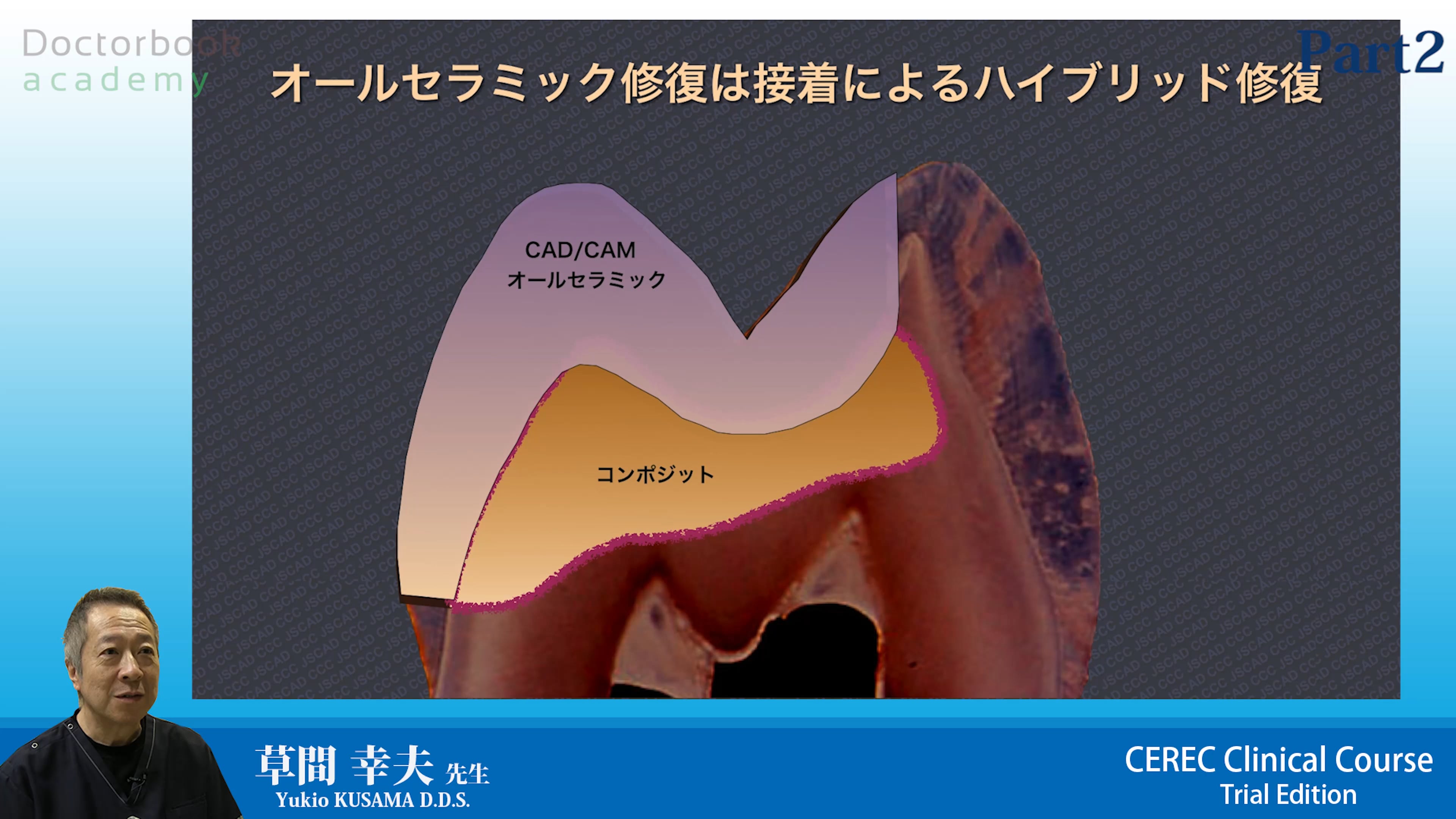 CEREC Clinical Course（CCC）トライアルエディション #2