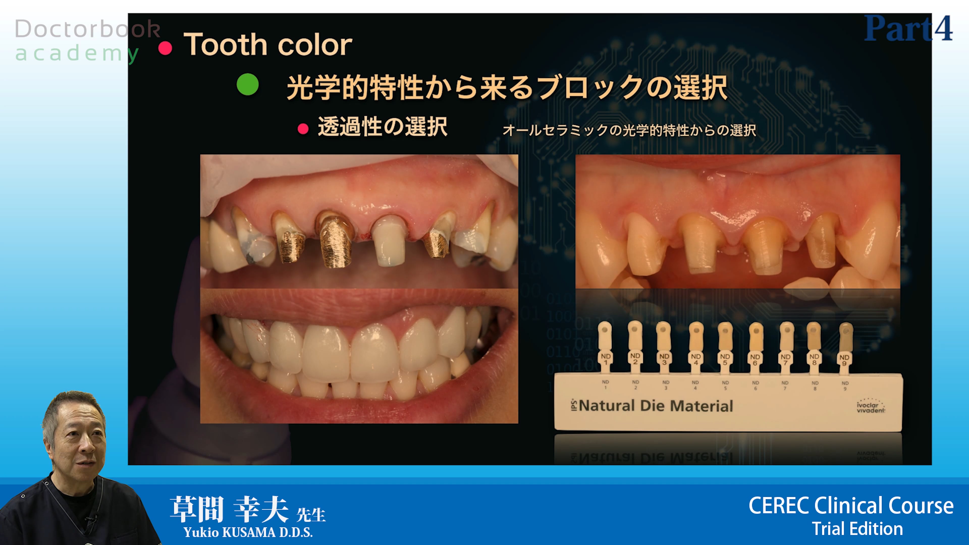 CEREC Clinical Course（CCC）トライアルエディション #4