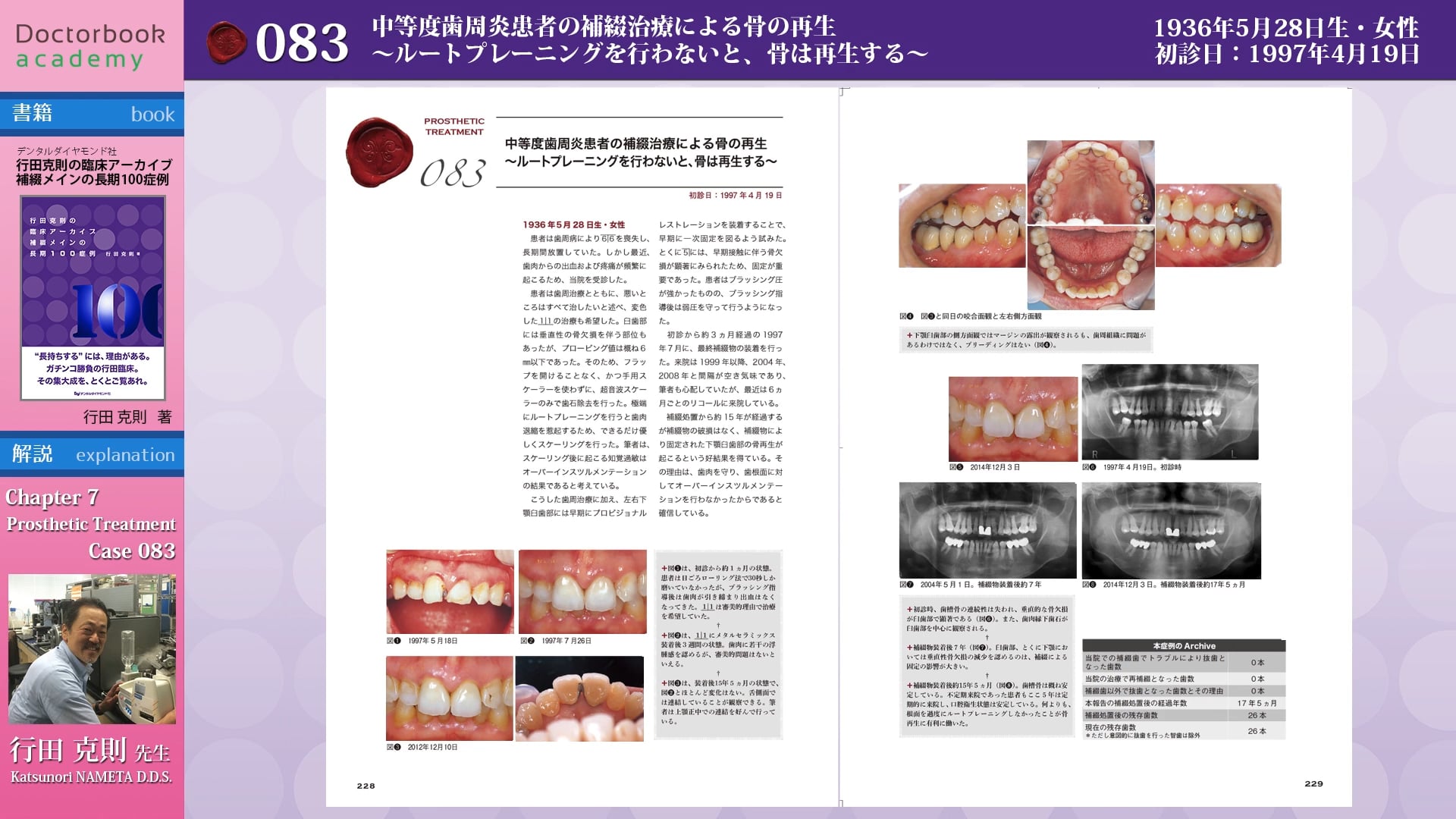 【BookReview】『 補綴メインの長期100症例』#2