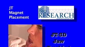 JT-3D Jaw Tracking - JT Magnet Placement