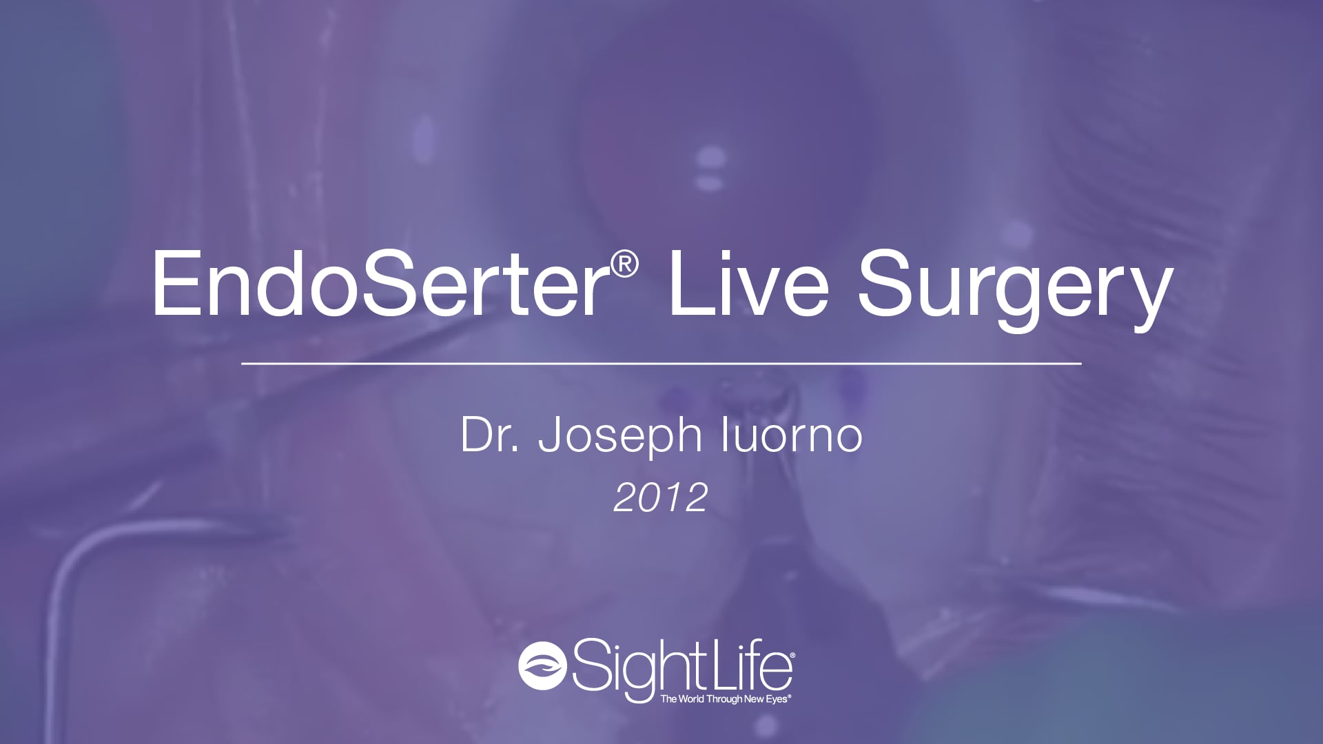 EndoSerter® Live Surgery Dr Joseph Iuorno, Richmond VA 2012 On Vimeo