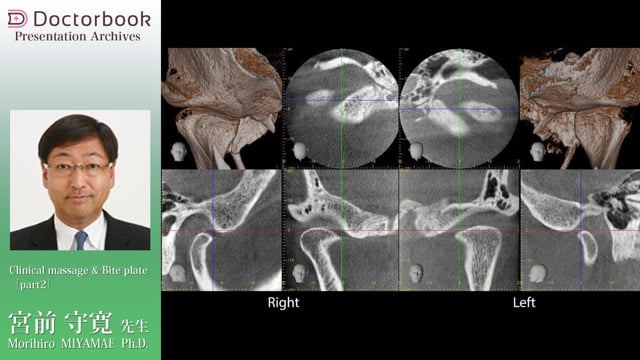 Clinical massage & Bite plate（後編）